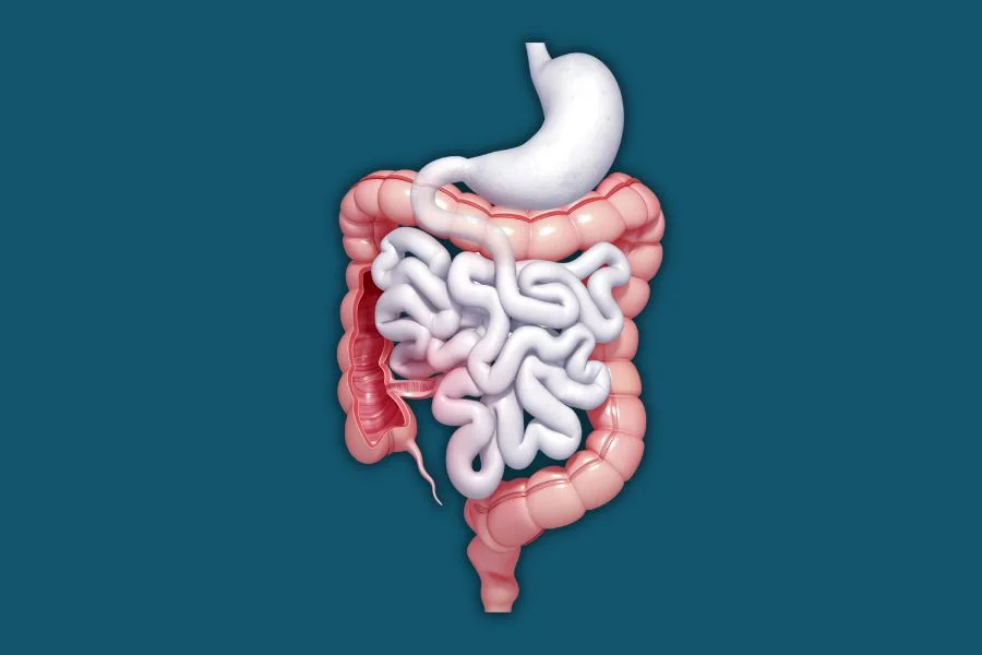 Darmgesundheit